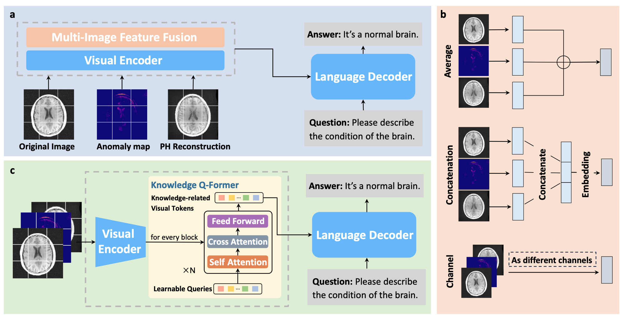 Language Models Meet Anomaly Detection for Better Interpretability and Generalizability