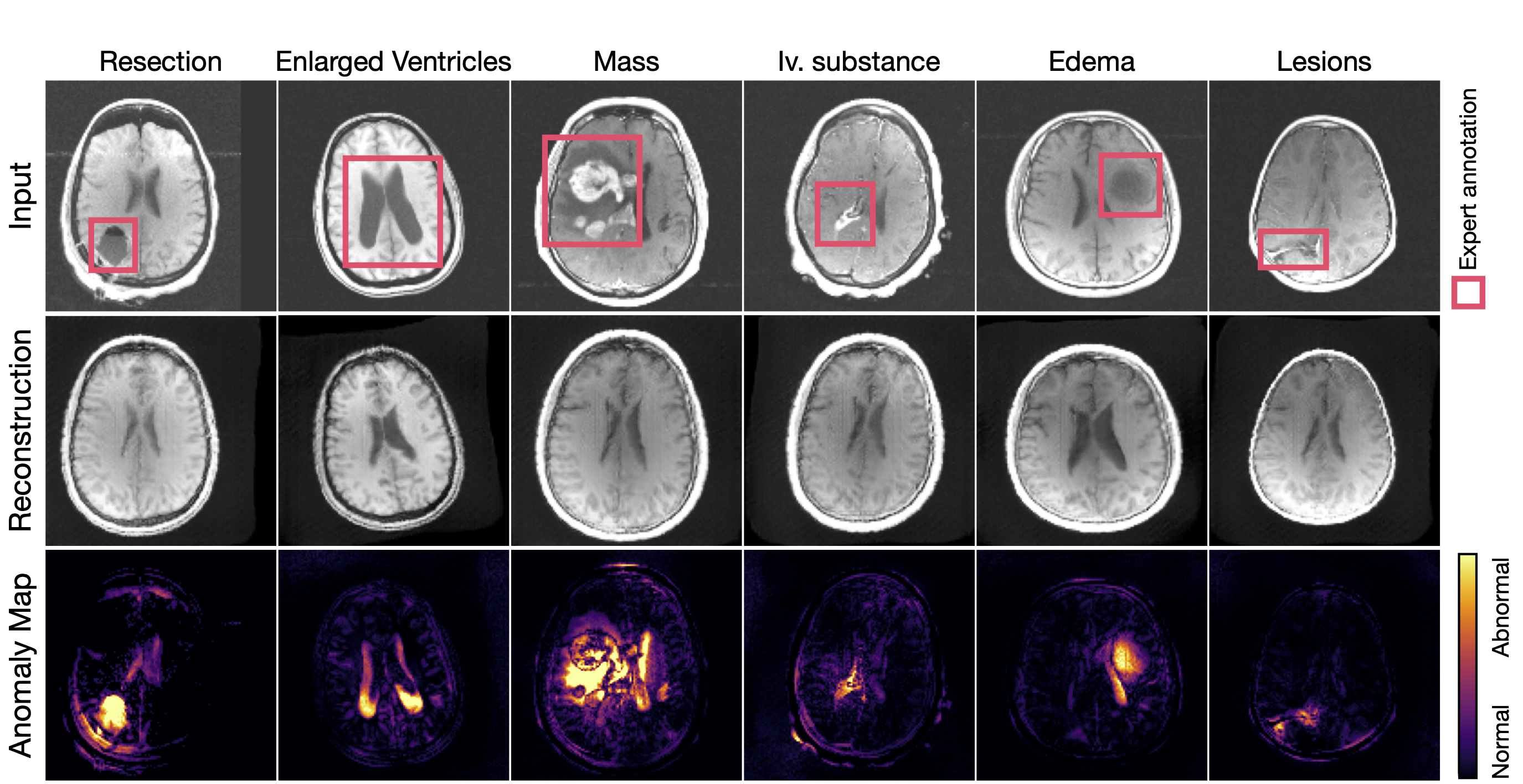 Generalizing Unsupervised Anomaly Detection: Towards Unbiased Pathology Screening